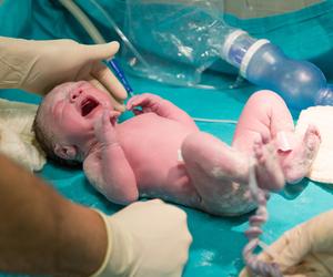 Mieli przeciąć pępowinę, gdy TO zobaczyli. To cud, że dziecko żyje