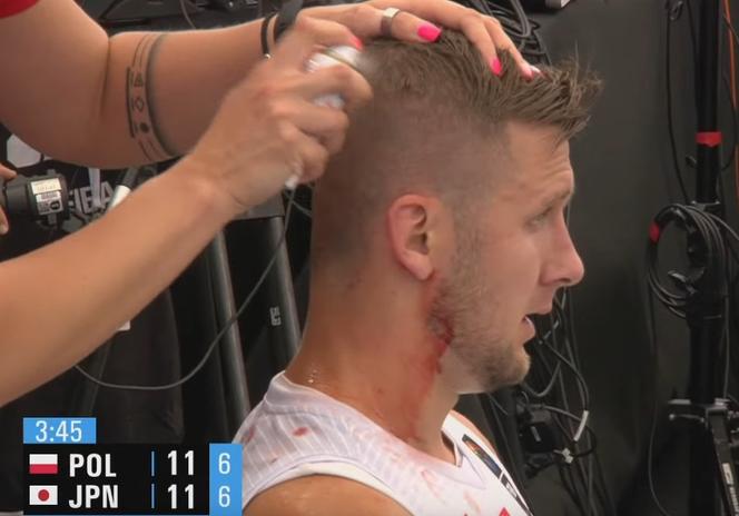 MŚ w koszykówce 3x3: Przemysław Zamojski trafiony łokciem