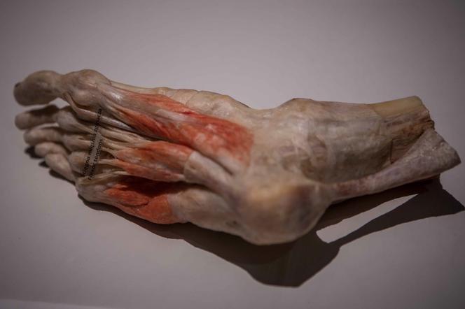 Bodies Revealed