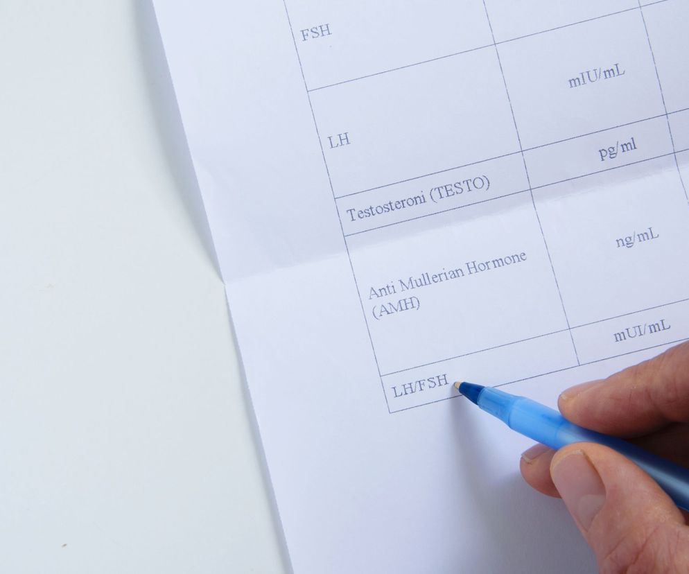 Poziom FSH i LH jest zależny u kobiet od dnia cyklu miesiączkowego oraz od wieku.