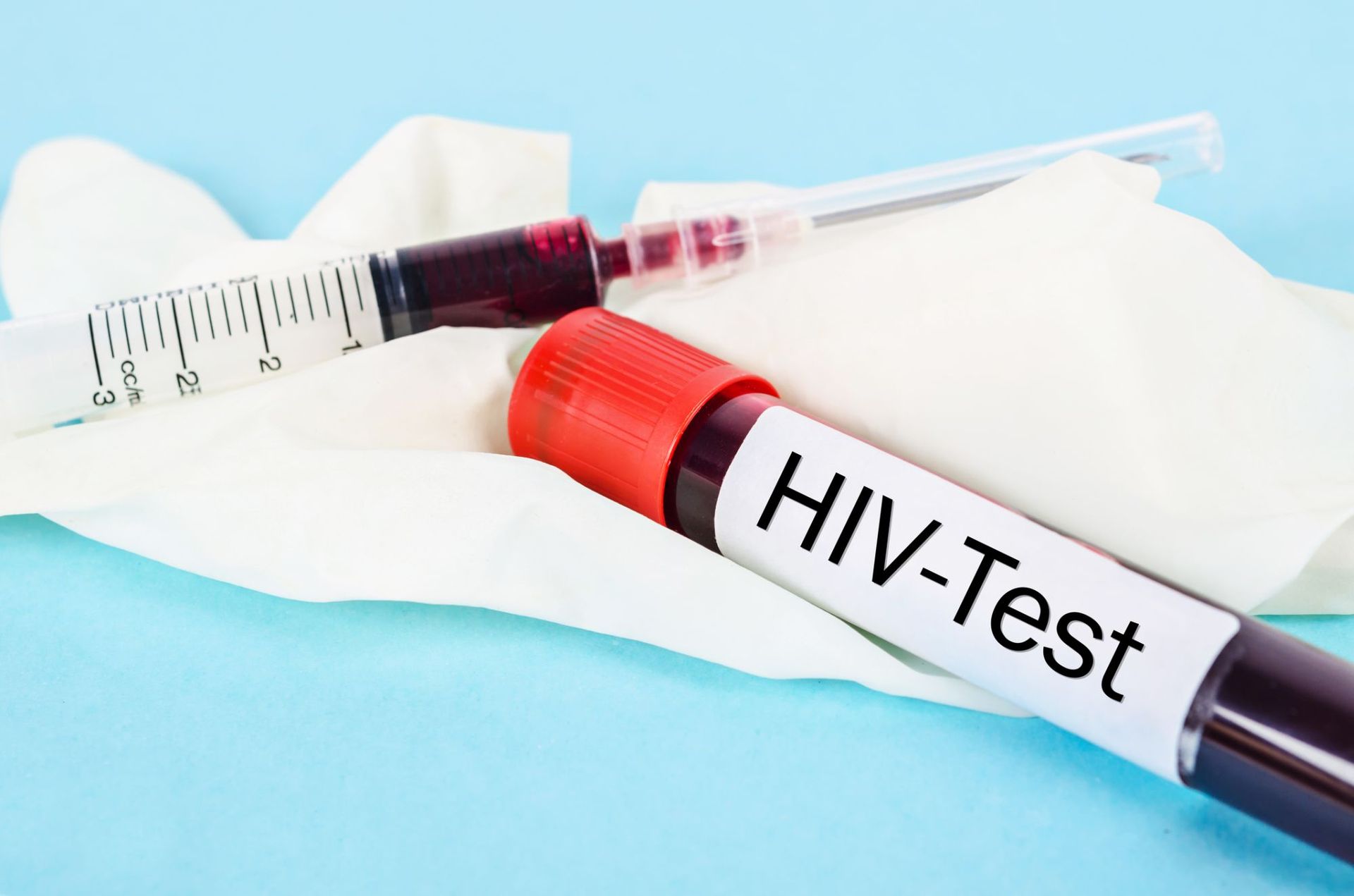 Test na HIV. Jak wygląda badanie na HIV i gdzie je wykonać? PoradnikZdrowie.pl