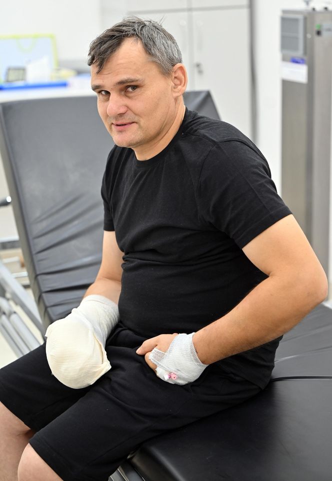 Lekarze z 5 Wojskowego Szpitala Klinicznego w Krakowie przyszyli oderwany kciuk panu Wojciechowi