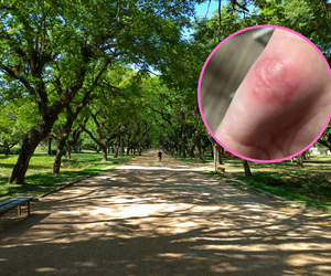 Chłopiec poparzył się w czasie zabawy w parku. Teraz jego babcia ostrzega innych