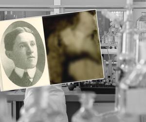  Odkrycie Marii Skłodowskiej-Curie zrujnowało mu życie. Uwaga! Zdjęcia są przerażające!