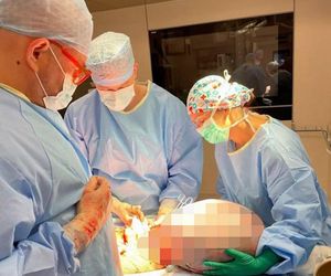 Ogromny guz jajnika usunięty w Centrum Onkologii w Bydgoszczy