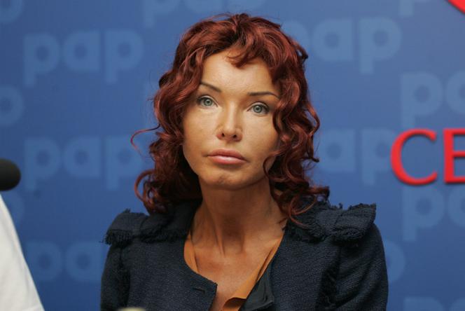 Sąd orzekł: Minge nie miała operacji plastycznych