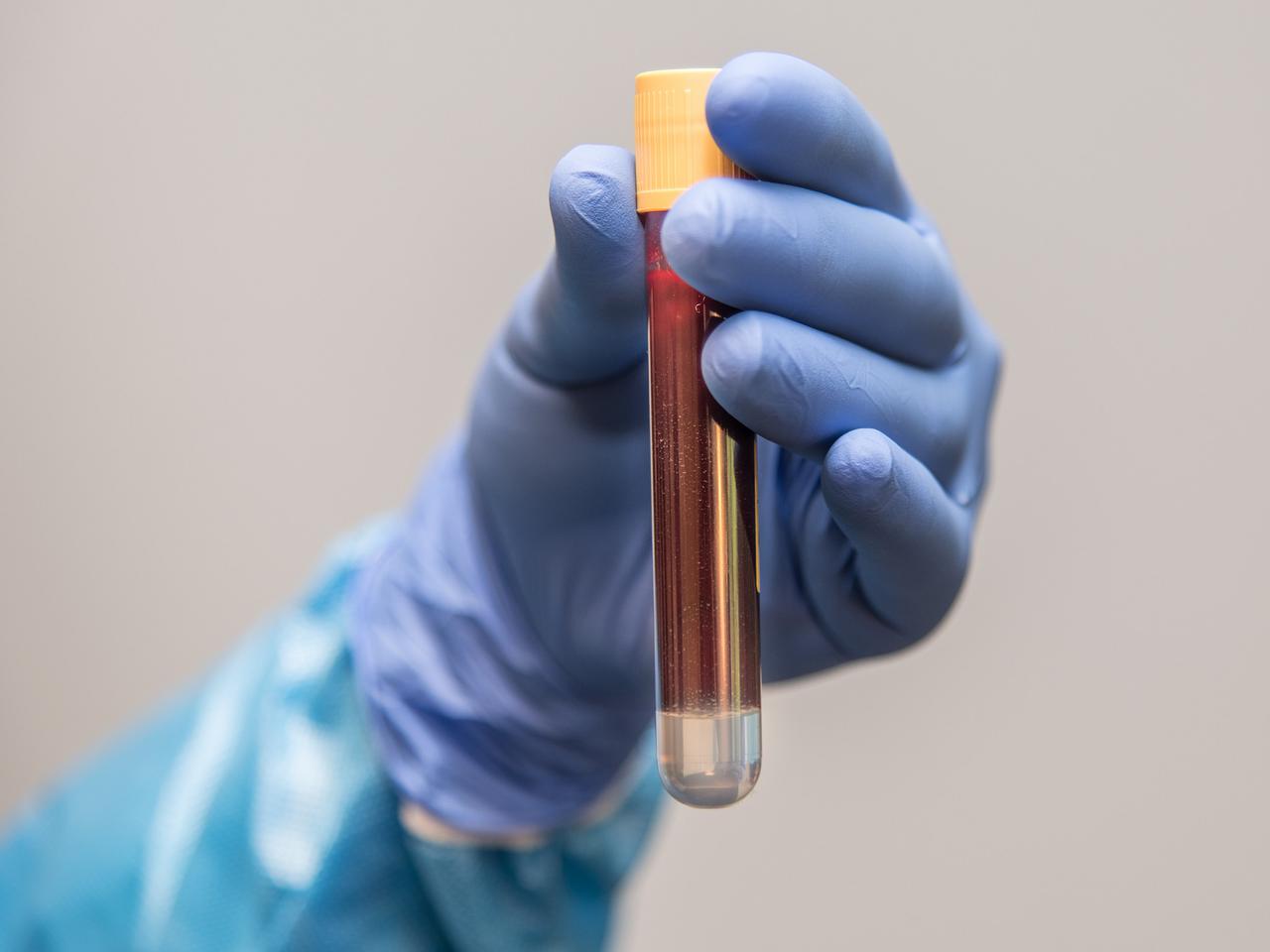 Każda kropla krwi na wagę złota! 