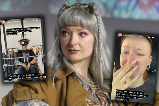 Red Lipstick Monster walczy z poważnymi dolegliwościami. Nie może normalnie funkcjonować