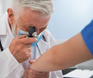 Choroby skóry, czyli dermatozy. Co warto o nich wiedzieć?