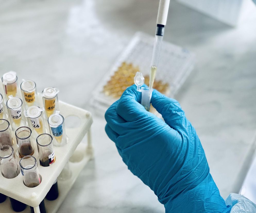 To badanie może wykryć raka trzustki we wczesnym stadium. “Kosztuje mniej niż grosz”