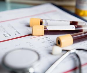 Masz za sobą covid? Zgłoś się do lekarza po skierowanie na te badania