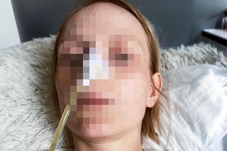 Narzeczona strażaka z Gdyni walczy o życie. Pomoc dla 27-letniej Pauliny pilnie potrzebna [ZDJĘCIA]