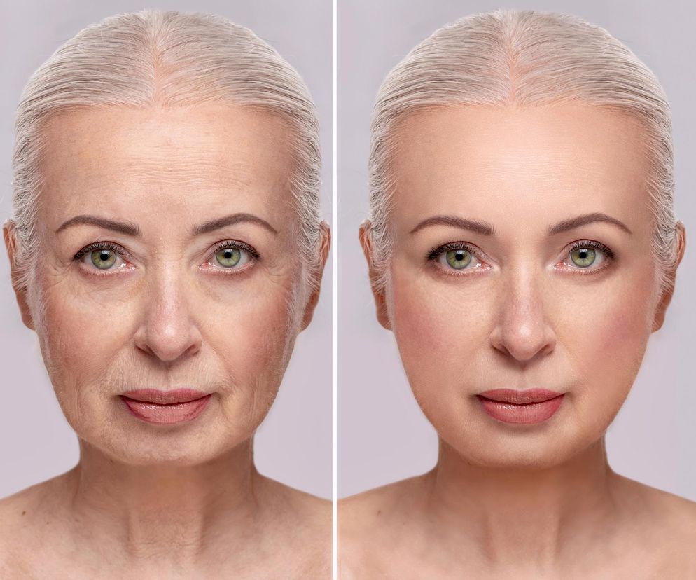 Usuwa zmarszczki już za 20 zł. „Złoto Madagaskaru” podbija polskie apteki