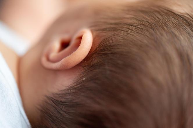 Dziecko ma czerwony pasek za uchem? Bacznie je obserwuj