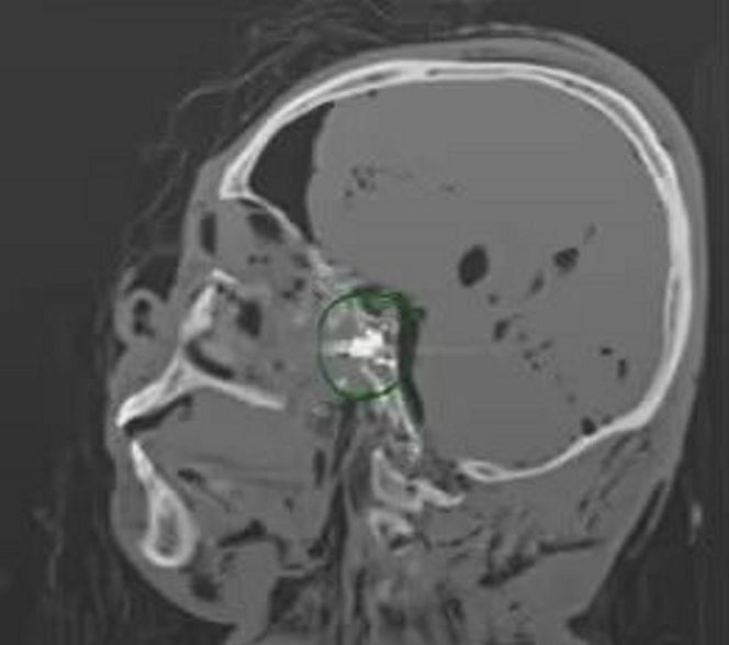 Ujawnił prawdę o sztucznej inteligencji. Znaleziono go martwego