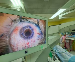 To pierwsza taka operacja na świecie. W Katowicach.