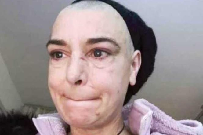 Sinead O'Connor pobita przez syna. 'Jesteś dla mnie martwy' 