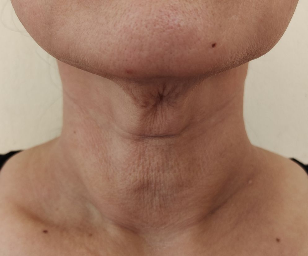 Naszyjnik Wenus może wpędzić a kompleksy. Winne codzienne nawyki