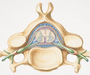 Nowotwory rdzenia kręgowego: objawy. Jak rozpoznać guzy rdzenia kręgowego?