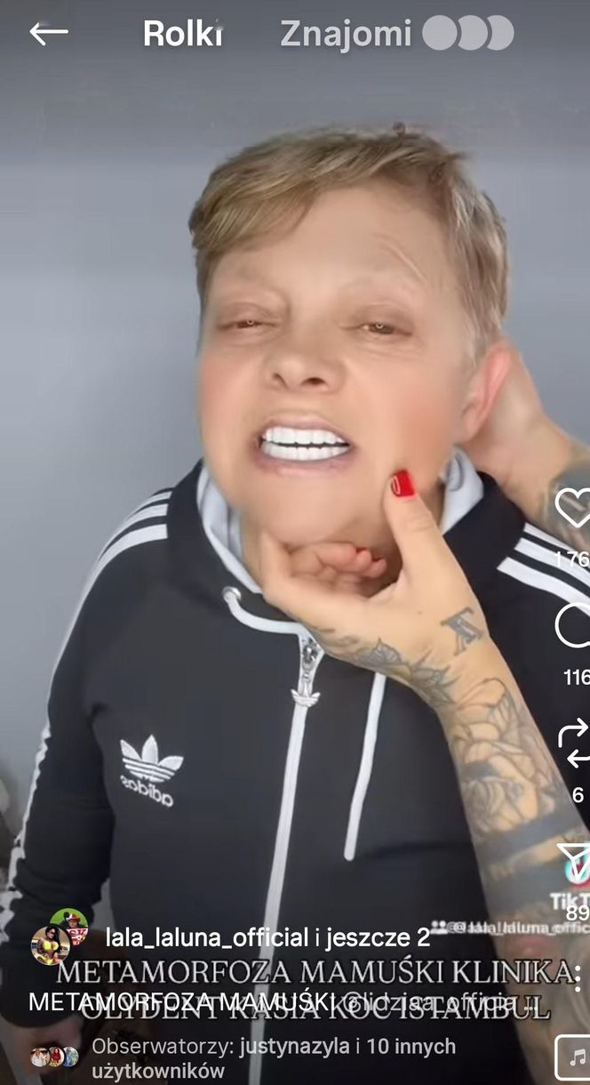 Laluna sprawiła mamie nowe zęby. "Dałaś mi drugie życie"