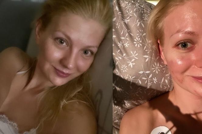 Straszny wypadek aktorki M jak miłość. Katarzyna Kołeczek trafiła do szpitala i ujawniła co się stało - ZDJĘCIA