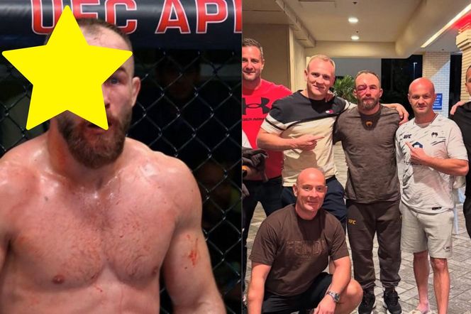 Krwawa masakra w walce Mateusza Rębeckiego w UFC. Pokazał zdjęcie po pojedynku