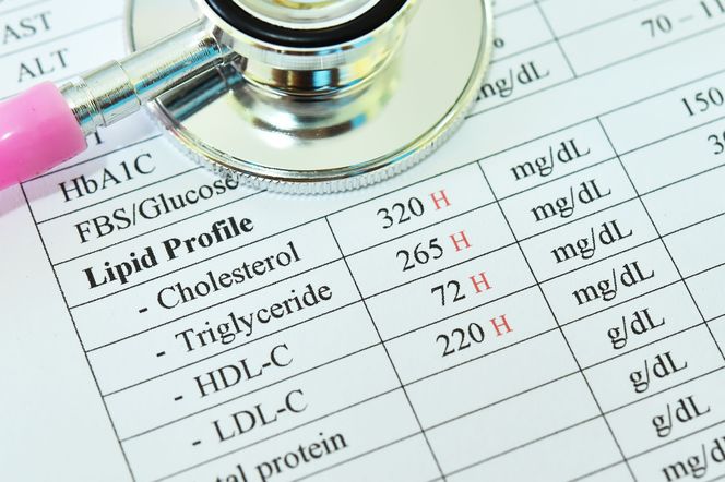 Ciężka hipertriglicerydemia: przyczyny, objawy, leczenie
