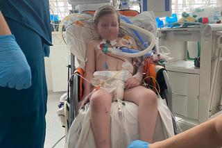 Gdańsk. Życie 6-letniego Aleksa uratowane. Inni lekarze nie dawali mu szans