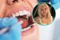 Dentystka Anita z „Sanatorium miłości” krytykuje modę na licówki z Turcji. Utrata zębów za hollywoodzki uśmiech