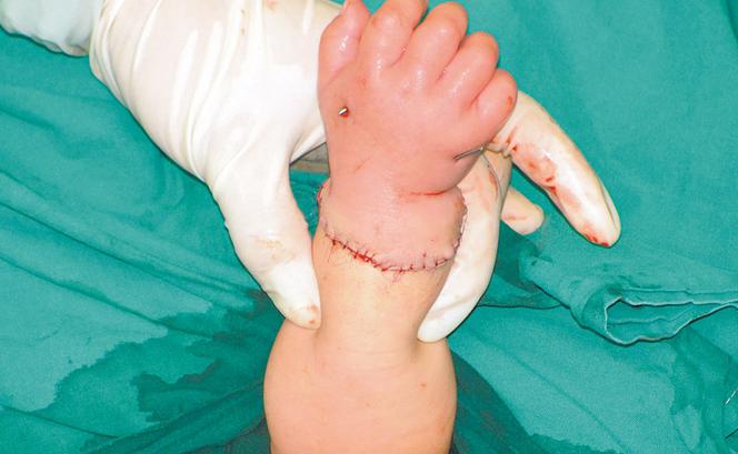 Babcia obcięła wnuczce rączki!