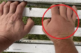 Pawła Kukiza pożądliły pszczoły 