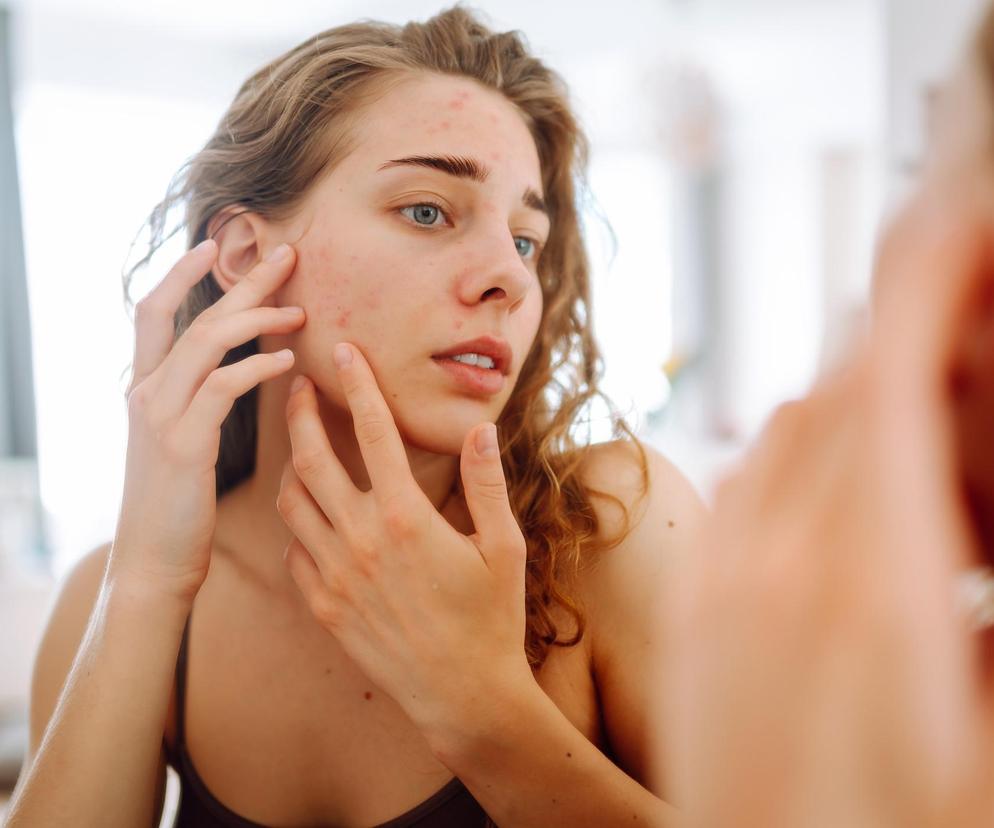 Przez makijaż można się opalić, a przez kremy z filtrem nie? Oto mity o wiosennej pielęgnacji skóry 