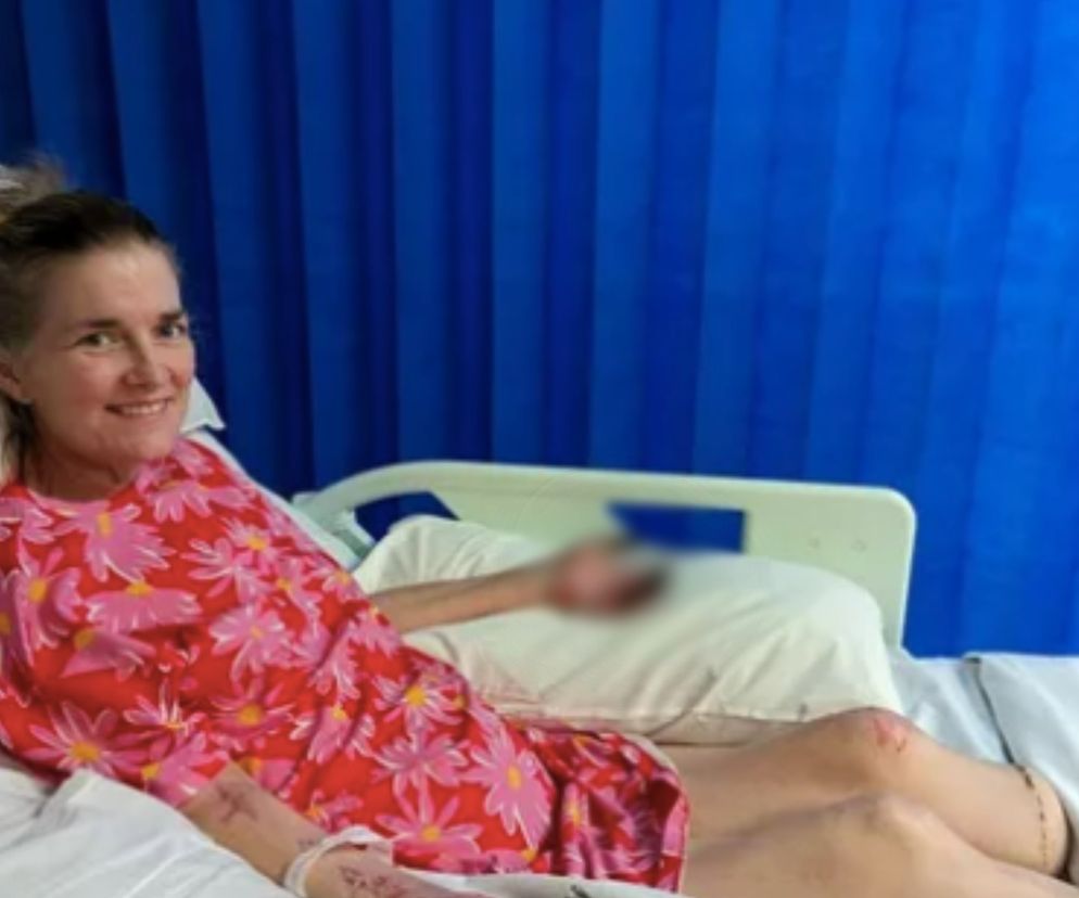 Myśleli, że to tylko grypa. Skończyło się amputacją nóg i palców