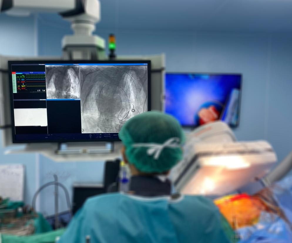 Dwie kolejne osoby dostały serca od świni. Eksperci mówią o ważnym kroku naprzód