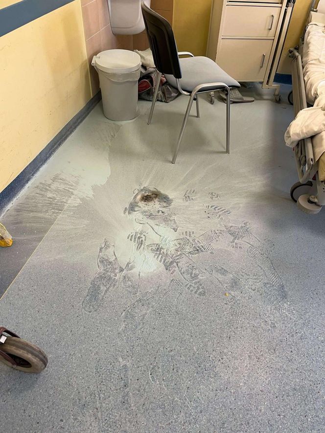 Nie było „dymka”, więc cisnął telefonem! Alarm w szpitalu, strażacy w akcji