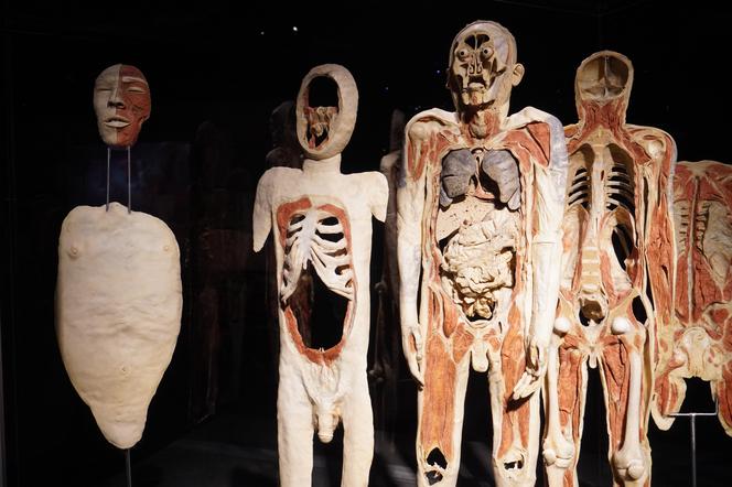 Wystawa z ludzkiego ciała. Body Worlds powróciła do Gdańska po 5 latach 