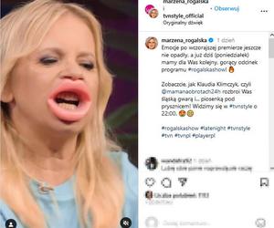 Ogromne usta Marzeny Rogalskiej! Co ona z sobą zrobiła?!