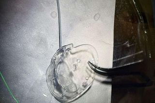 Leczenie nie przynosiło efektów. Pan Krzysztof od 20 lat żył z ciągłym bólem. Z pomocą przyszli lekarze z Katowicach