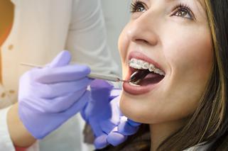 Powikłania po leczeniu ortodontycznym