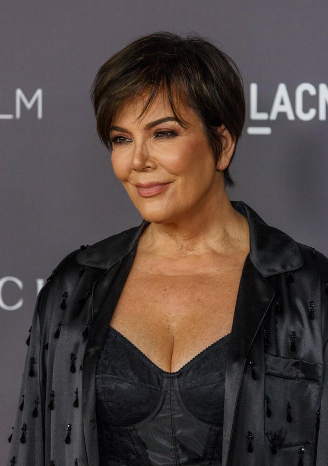 Kupiła sobie nową twarz za 360 tysięcy złotych! Nie poznasz tej gwiazdy