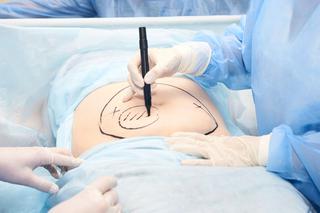 Histerektomia - na czym polega i kiedy wykonuje się chirurgiczne usunięcie macicy?