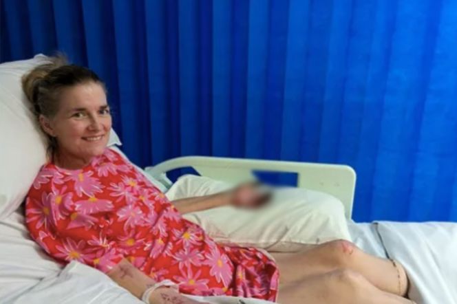 Myśleli, że to tylko grypa. Skończyło się amputacją nóg i palców