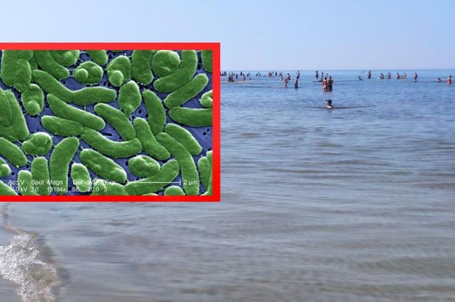 Vibrio vulnificus w Bałtyku