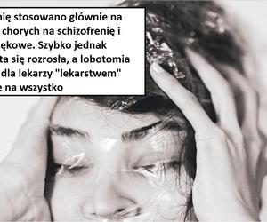 W tych przypadkach stosowano lobotomię