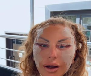 Dagmara Kaźmierska po operacji twarzy