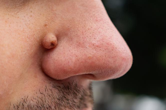 Zbliżenie na nos mężczyzny 