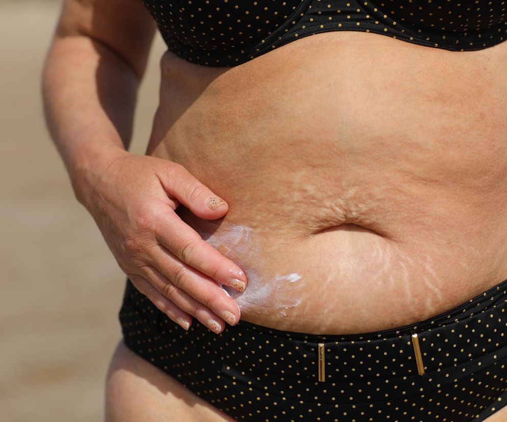 To musisz wiedzieć o naturalnym Ozempicu. Berberyna kontra semaglutyd 