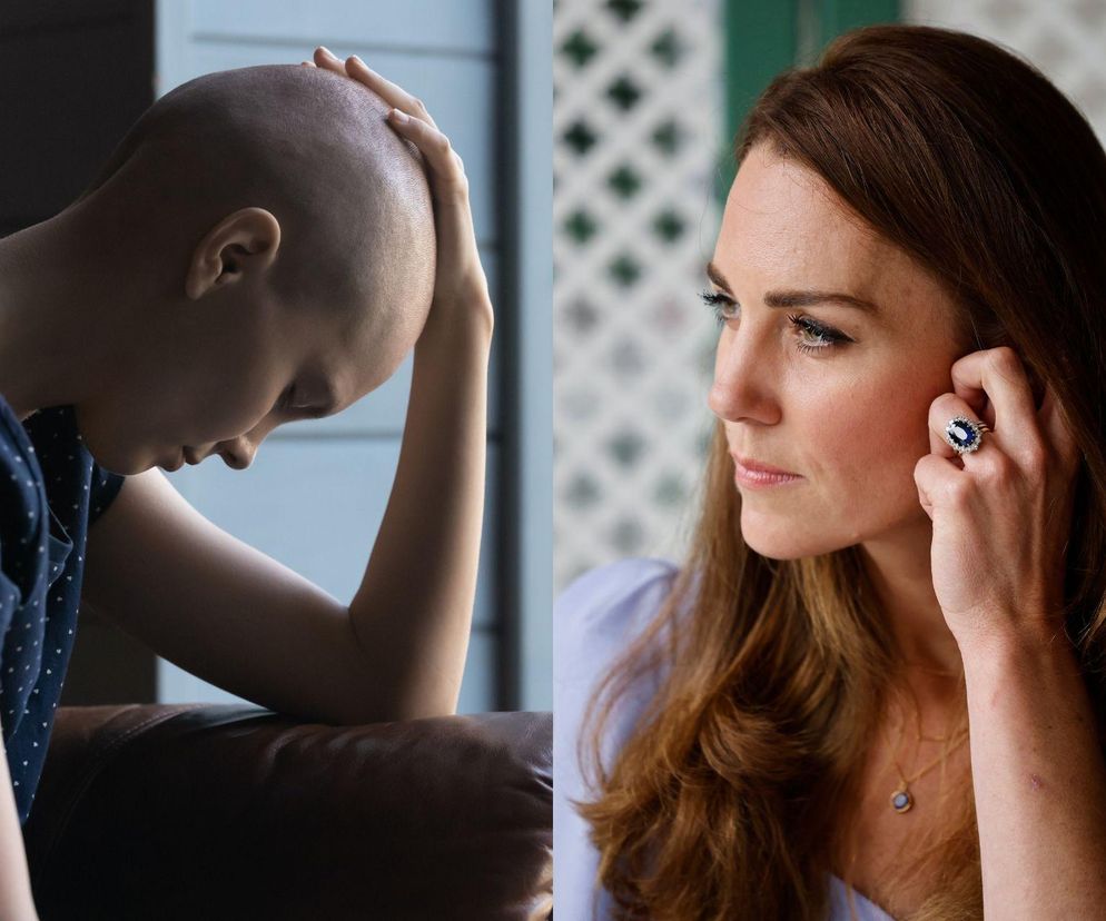 Diagnoza Kate Middleton to nie wyjątek. Epidemia nowotworów u młodych ludzi