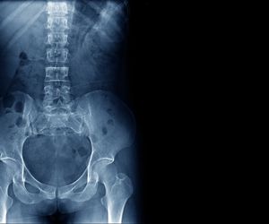 Spojenie łonowe - gdzie jest? Ból i rozejście spojenia łonowego