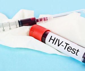 Test na HIV. Jak wygląda badanie na HIV i gdzie je wykonać?